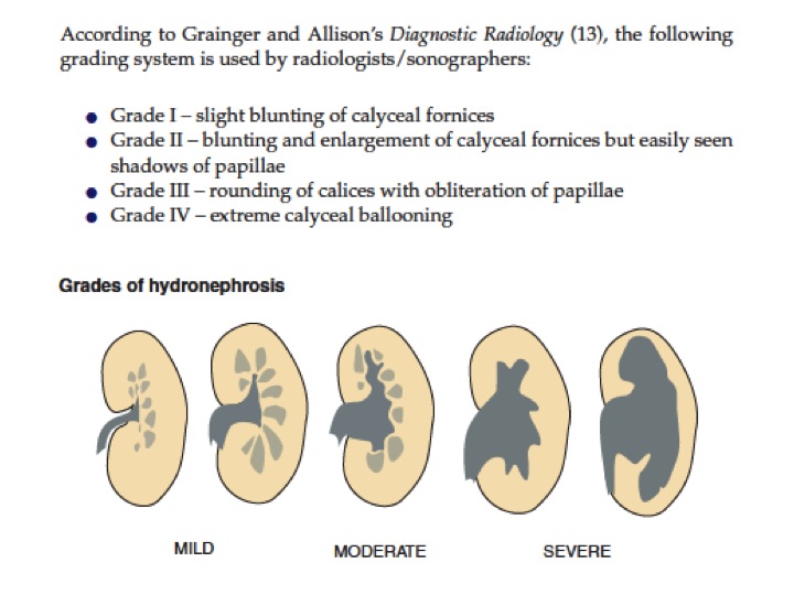 Hydronephrosis grading